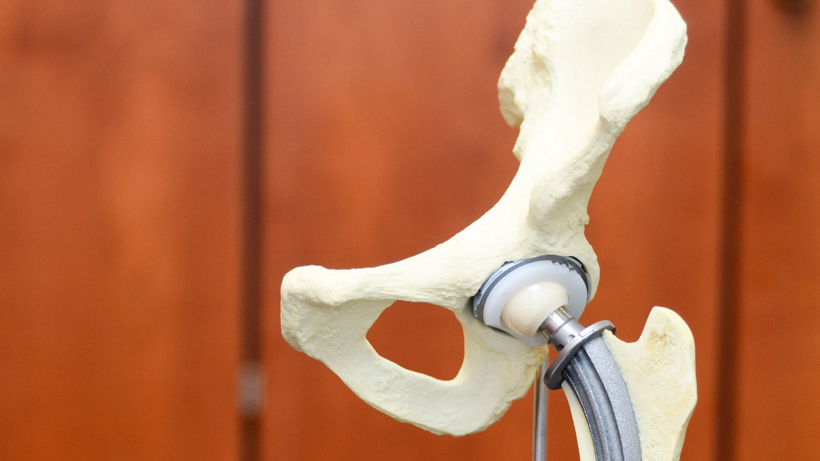 Hip replacement surgery in Germany